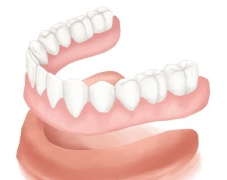 Happy older couple smiling, showing their beautiful white teeth