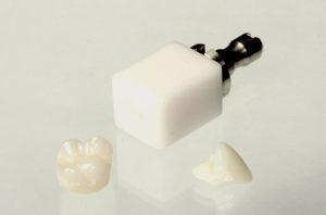 CEREC crowns and a block of porcelain